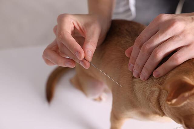 Acupuncture